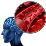 Is poor nitric oxide production contributing to your Multiple Sclerosis symptoms?