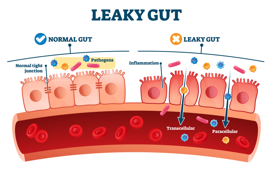 leaky gut symptoms causes and how to heal it