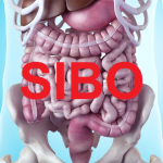 Sibo whole body consequences