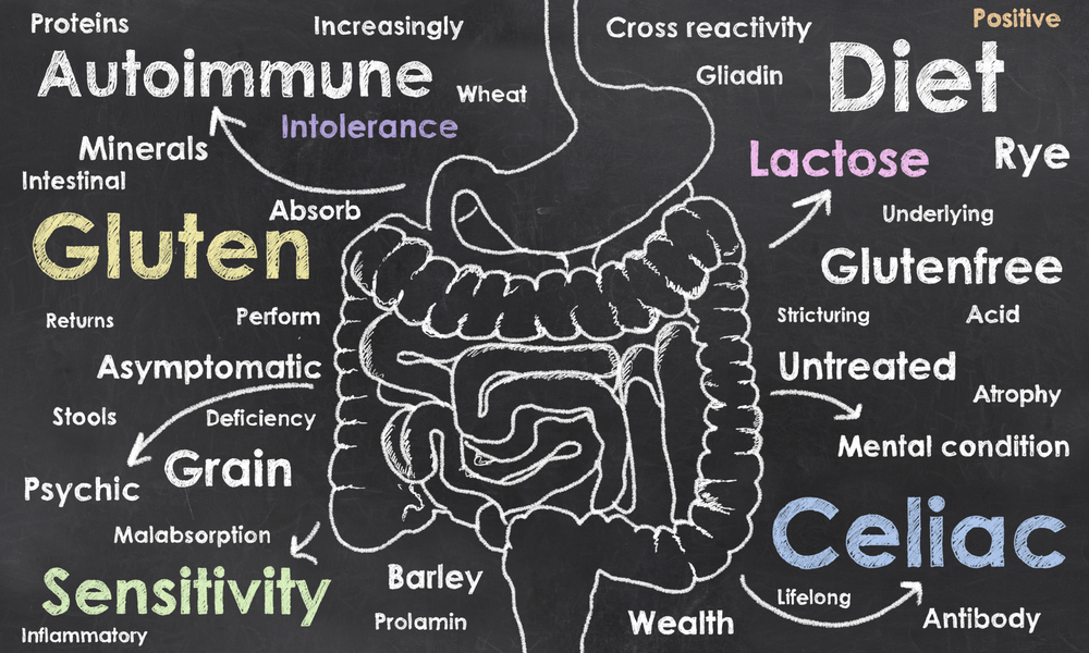 food allergy, sensitivity, or intolerance